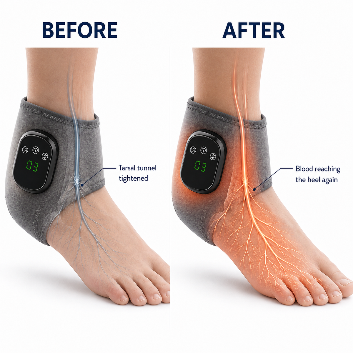 FlowLab NeuroWrap
